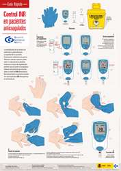 Control INR en pacientes anticoagulados. Guía Rápida